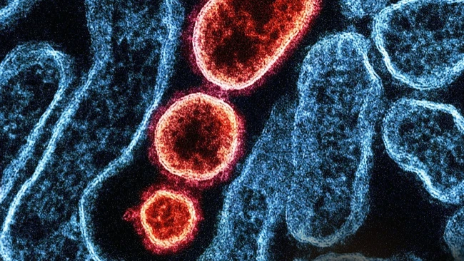 Már Indián kívül is szedett halálos áldozatot a Nipah-vírus