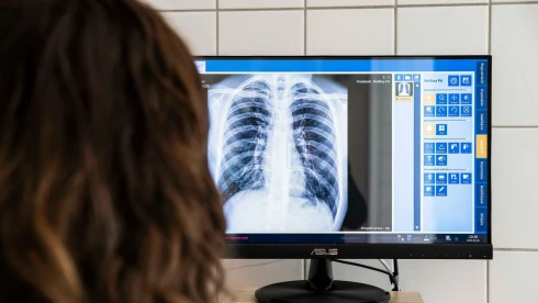 Kocsis Máté: Magyar Péter átveri a híveit!