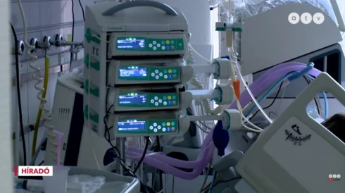 Alaposan szemügyre vették a kiszivárgott reformtervet a szakértők, ez a véleményük róla