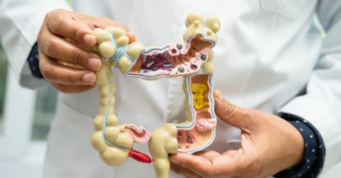 Ordítja a friss tanulmány! Súlyos tévedésben éltek az orvosok: most kiderült, hogy mi a vakbél valódi feladata