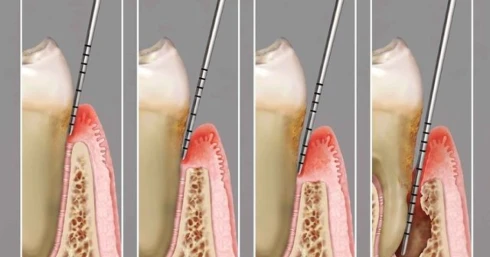 A legtöbb fogatlan ember Európában magyar