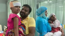 Első fokon elmarasztaló ítélet született a bangladesi sziámi ikrek ügyében