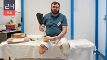 „A legjobb ajándék lesz anyukámnak, hogy tudok járni” – Budapesten kaptak művégtagot az ukrajnai háború sérültjei